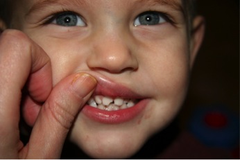 kid-with-chipped-tooth-examination-at-pediatric-dentistry-clinic-scottsdale